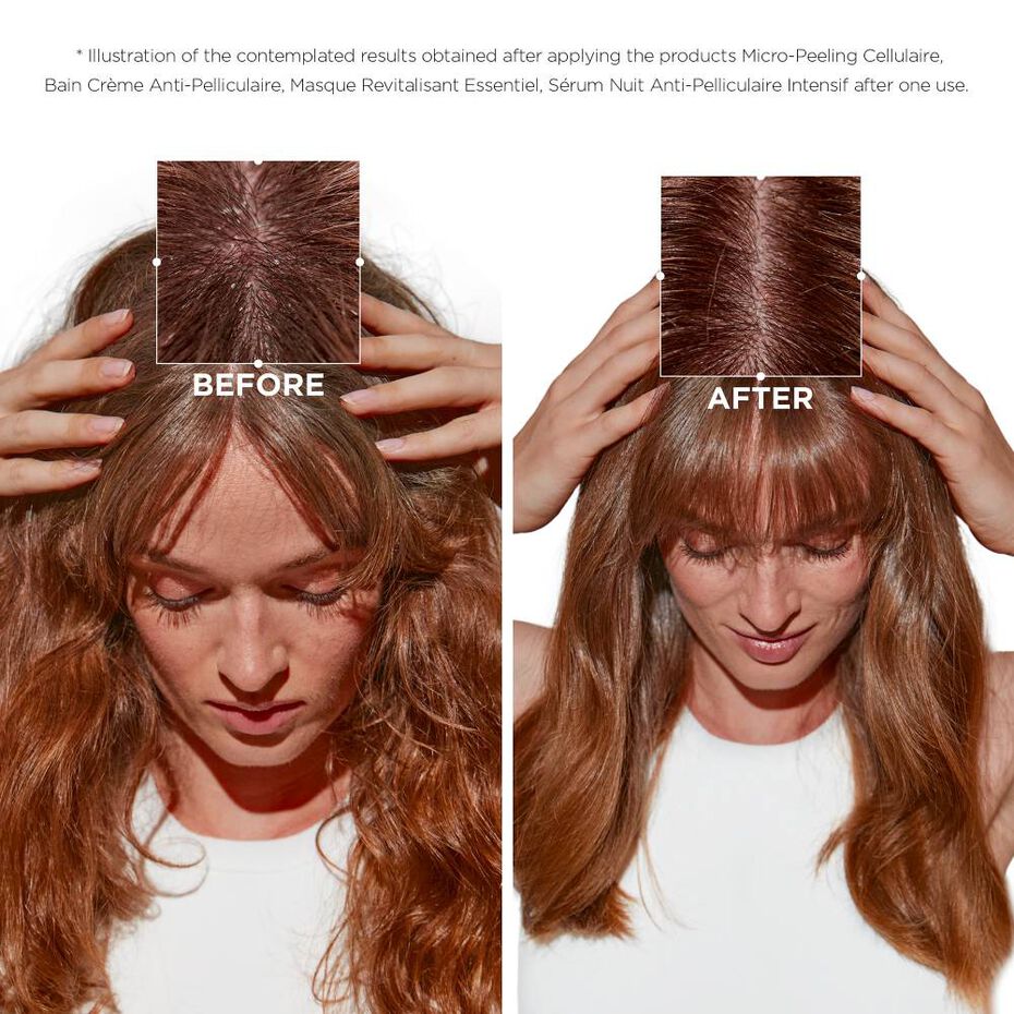 Kérastase Symbiose Micro-Peeling Cellulaire Scalp Scrub for Dandruff 200ml - Image 5